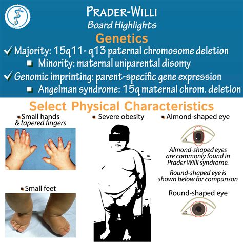 prada willi syndrome symtoms|prader willi syndrome early signs.